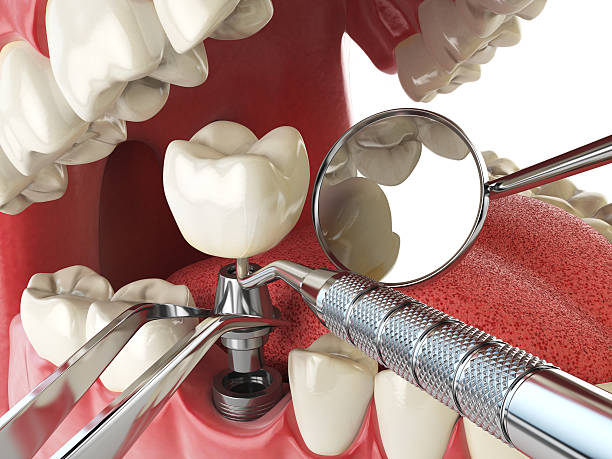 Best Weekend Emergency Dentist in Wyoming, IL